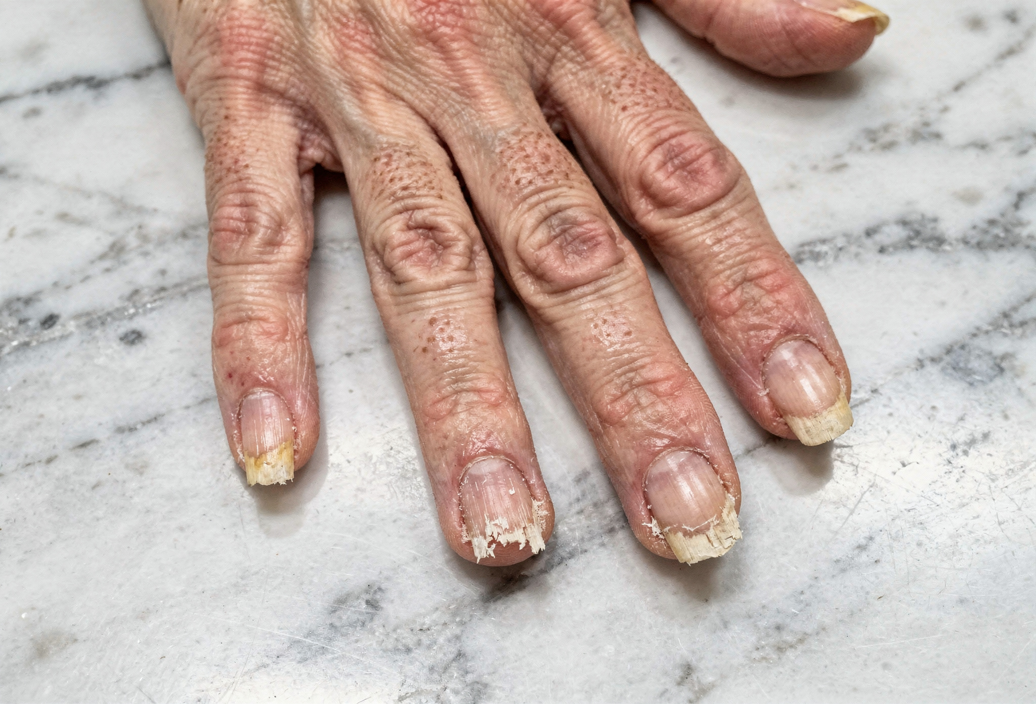 Bakım öncesi — doğal ve bakımsız tırnaklar beyaz mermer üzerinde